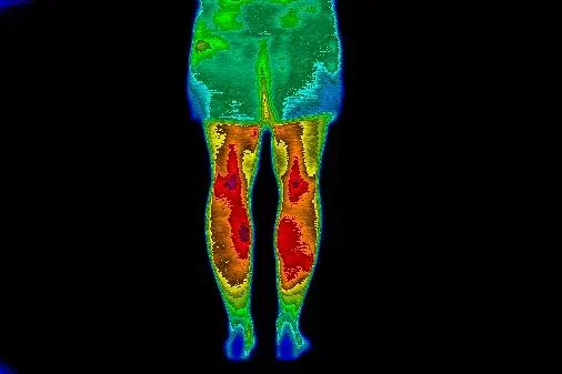 Thermal image showing 30-minute ice recovery condition